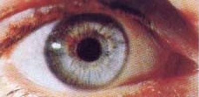  Herczeg Optika - Foto