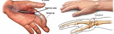 Dr. Király Géza kézsebész, traumatológus, igazságügyi orvosszakértő Győr