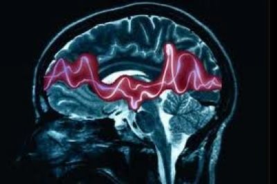 Dr. Dravetzky Éva akupunktőr, neurológus szakorvos Baranya megye