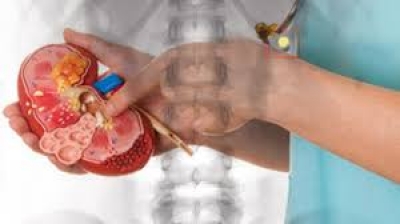 Dr. med. habil Gervain Mihály urológus, nephrológus és sebész főorvos 
